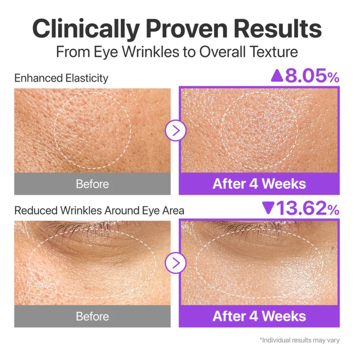 روتين NUMBUZIN رقم 9 يشدّ البشرة بلا حقن