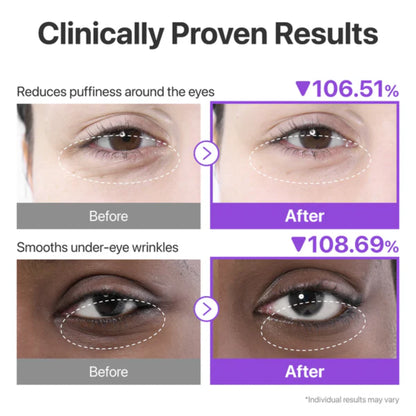 روتين NUMBUZIN رقم 9 يشدّ البشرة بلا حقن